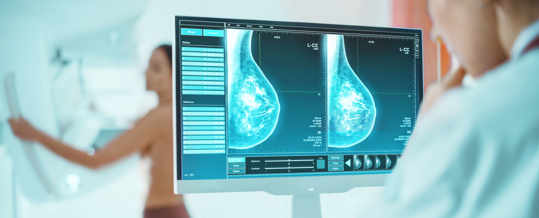 Thomosynthese 3D Mammographie im MVZ Köln